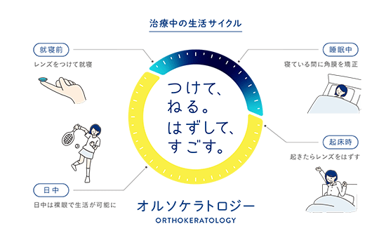 オルソケラトロジー治療とは